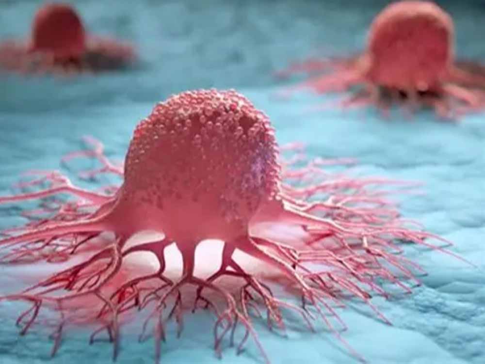 शोध रिपोर्ट: पूर्वोत्तर भारत में पुरुषों पर बढ़ रहा कैंसर का संकट