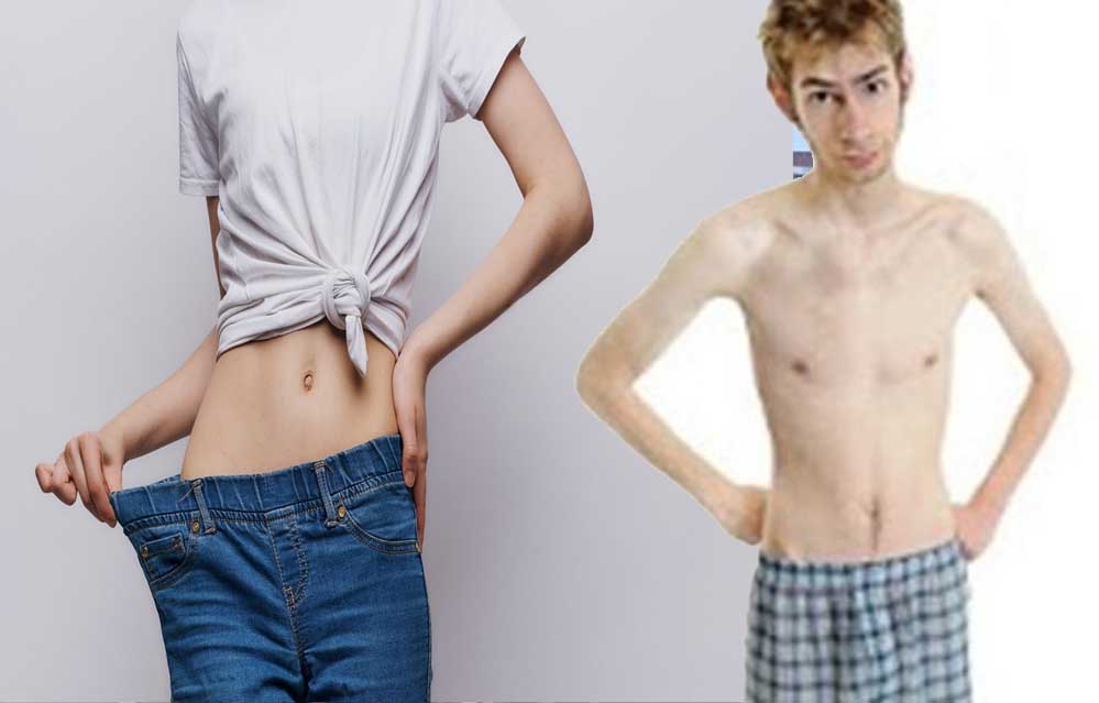 स्वास्थ्य चेतावनी! अत्यधिक दुबलेपन से 3 गुना बढ़ जाता है असमय मौत का जोखिम