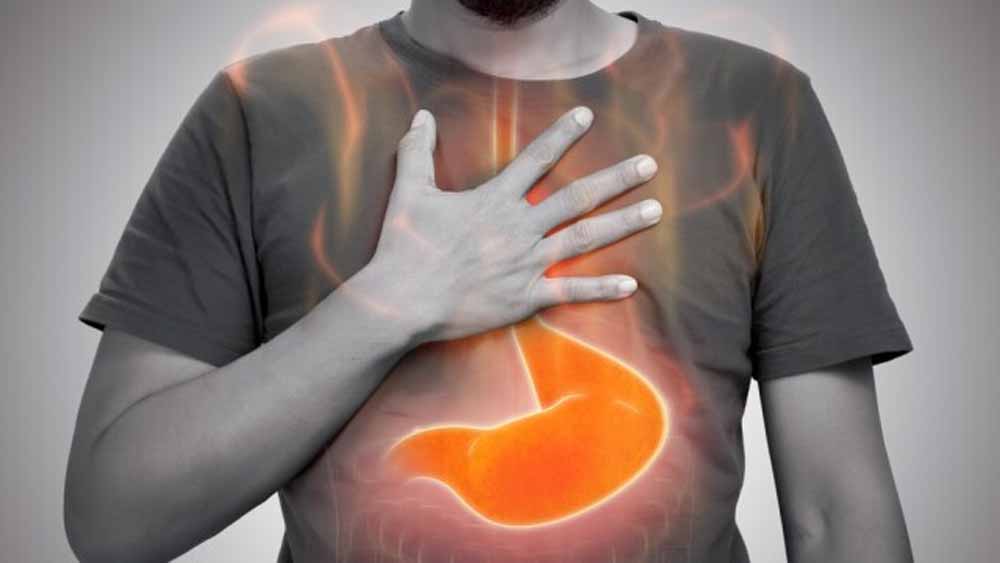 मसालेदार खाना छोड़कर भी हो सकता है एसिड रिफ्लक्स! इन 5 कारणों से रहें सतर्क