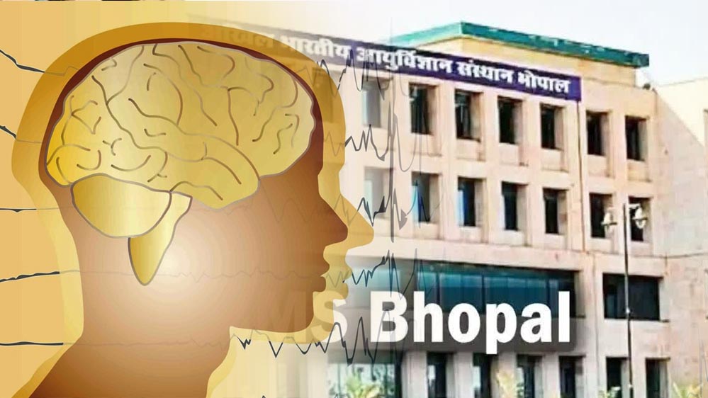 एम्स भोपाल में शुरू हुई एडवांस्ड स्ट्रोक ट्रीटमेंट यूनिट, 24 घंटे उपलब्ध रहेगा इलाज