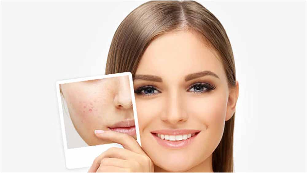 जिद्दी दाग-धब्बों से छुटकारा पाने का आसान तरीका: चावल का घरेलू नुस्खा