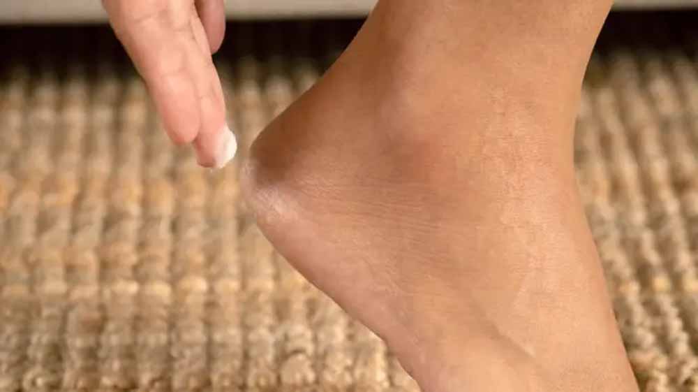 सर्द के मौसम में एड़ियों की करें सही देखभाल!