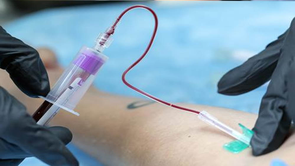 सिर्फ एक साधारण ब्लड टेस्ट से पता चलेगा आप कितने दिन जिएंगे