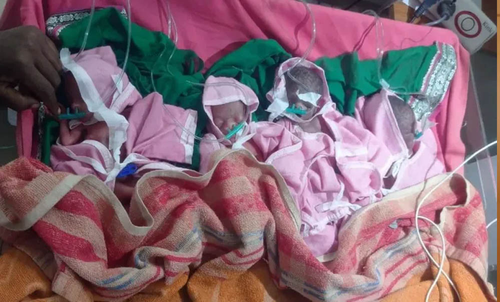 जुन्नारदेव में दुर्लभ घटना: महिला ने दिया चार बच्चों को जन्म, जिला अस्पताल में तैयारियां शुरू