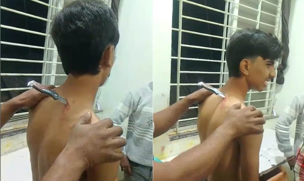गर्दन में चाकू फंसा, 46 किमी दूर अस्पताल तक पहुंचा नाबालिग; महिदपुर में विवाद में हिंसा