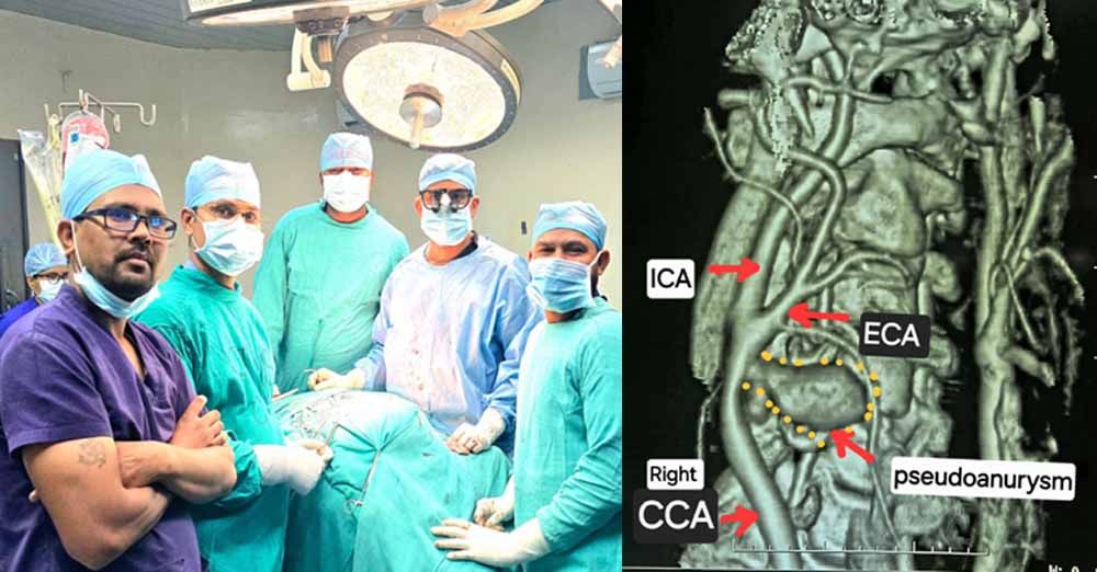 छत्तीसगढ़ के मेकाहारा हॉस्पिटल के डॉक्टरों ने ब्रश करते समय फटी गर्दन की नस में की दुर्लभ सर्जरी