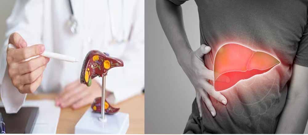 आपका लिवर हेल्दी है या खराब, 20 सेकेंड में टेस्ट करें!